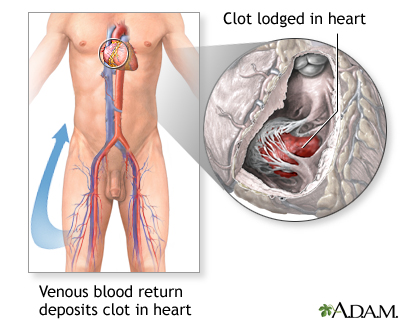 Procedure, part 1 Procedure, part 1