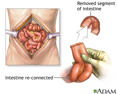 Procedure Procedure