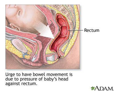 Emergency Childbirth Emergency Childbirth