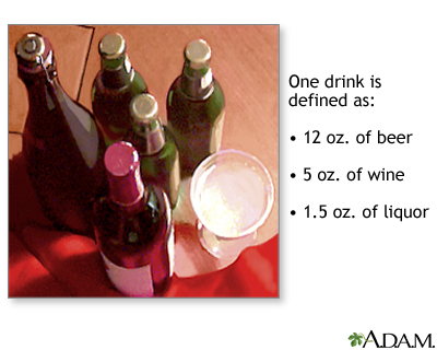 Alcoholism Alcoholism