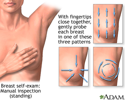 Breast self-exam Breast self-exam