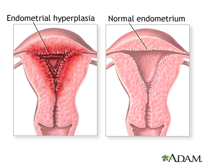 Abnormal menstrual periods Abnormal menstrual periods