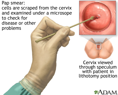 Pap smear Pap smear