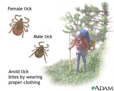 Ehrlichiosis Ehrlichiosis