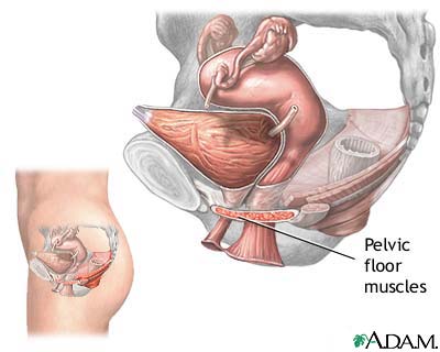 Stress incontinence Stress incontinence