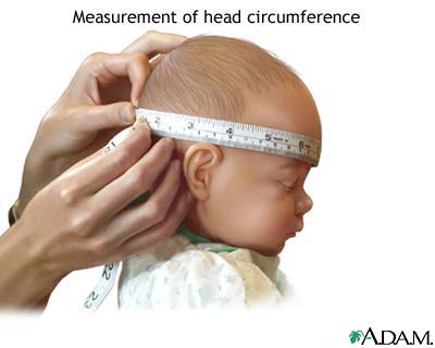 Head circumference Head circumference