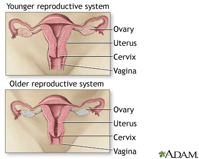 Menopause Menopause