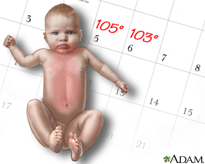 Roseola Roseola