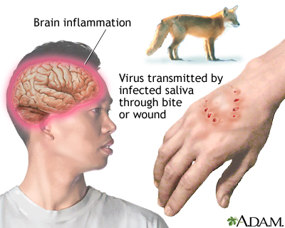 Rabies Rabies