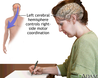 Left cerebral hemisphere - function Left cerebral hemisphere - function