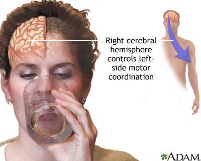 Right cerebral hemisphere - function Right cerebral hemisphere - function