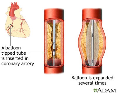 Procedure, part 3 Procedure, part 3