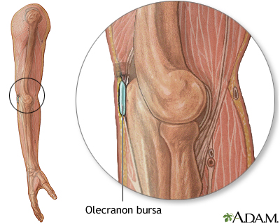 Bursa of the elbow Bursa of the elbow