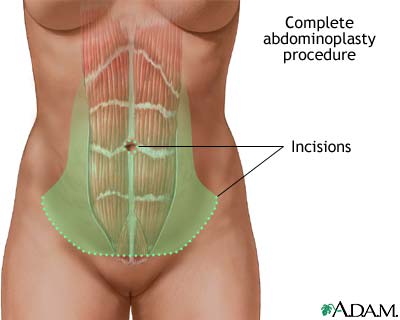 Procedure, part 1 Procedure, part 1