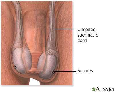 Procedure Procedure