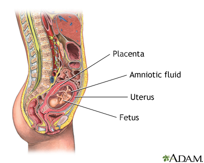Amniocentesis - series - Indication Amniocentesis - series - Indication