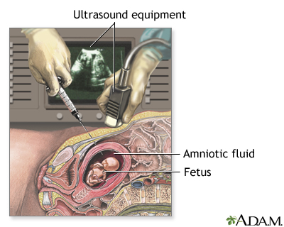 Procedure, part 1 Procedure, part 1