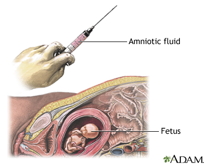 Procedure, part 2 Procedure, part 2