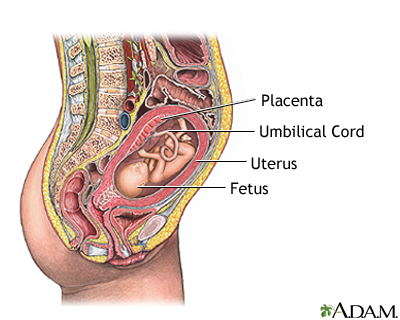 Percutaneous umbilical cord blood sampling - series Percutaneous umbilical cord blood sampling - series