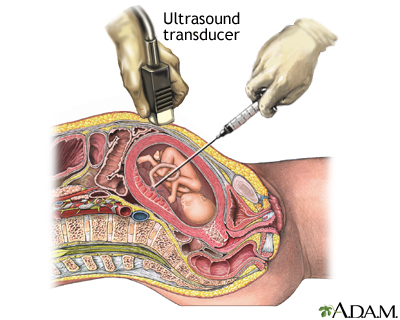 Procedure, part 1 Procedure, part 1