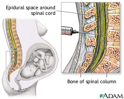 Procedure, part 1 Procedure, part 1