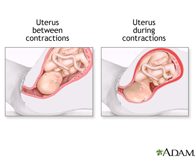 Procedure, part 2 Procedure, part 2