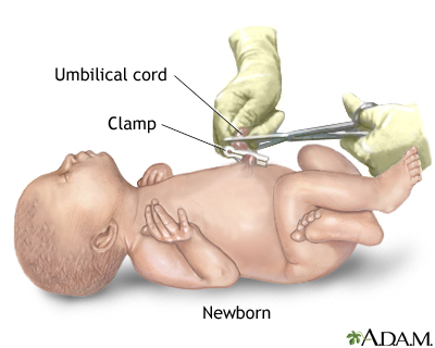 Procedure, part 6 Procedure, part 6