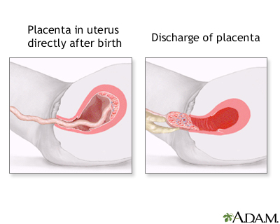 Procedure, part 7 Procedure, part 7