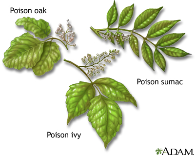 Poison plants Poison plants