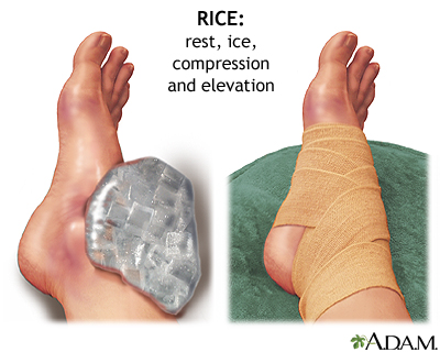 Early treatment of injury Early treatment of injury