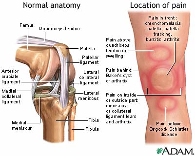 Knee pain Knee pain