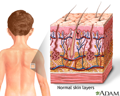 Skin Skin