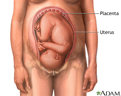 Placenta Placenta