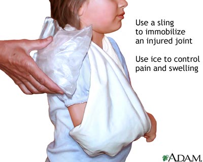 Triangular shoulder sling Triangular shoulder sling