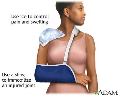 Shoulder sling Shoulder sling