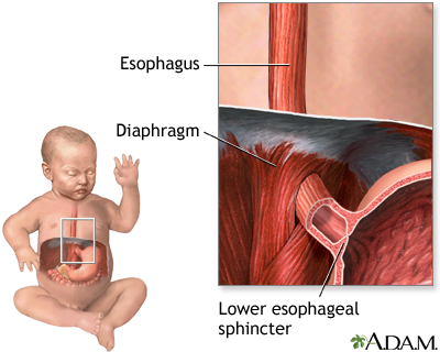 Baby spitting up Baby spitting up