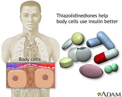 Thiazolidinediones Thiazolidinediones