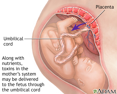 Substance use during pregnancy Substance use during pregnancy
