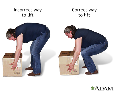 Proper lifting technique Proper lifting technique