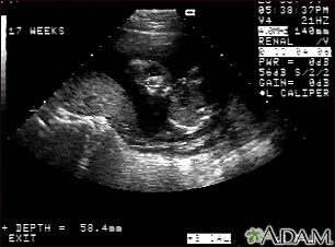 Ultrasound, normal fetus - face Ultrasound, normal fetus - face