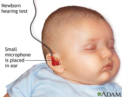 Hearing test Hearing test