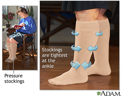 Pressure stockings Pressure stockings