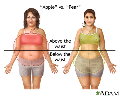 Different types of weight gain Different types of weight gain