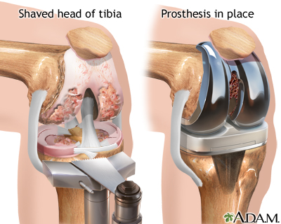 Procedure Procedure