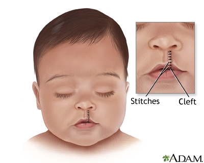 Procedure Procedure