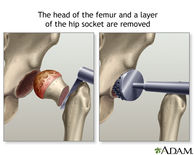 Procedure, part 1 Procedure, part 1