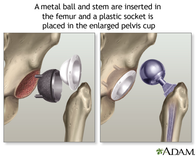 Procedure, part 2 Procedure, part 2