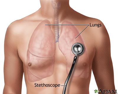 Breath sounds Breath sounds