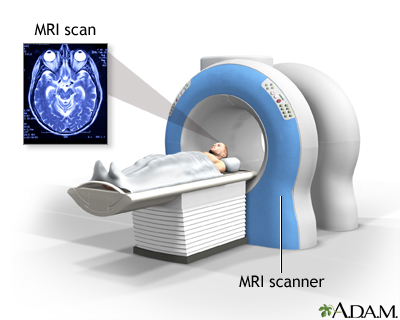 Head MRI Head MRI