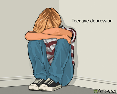 Teenage depression Teenage depression
